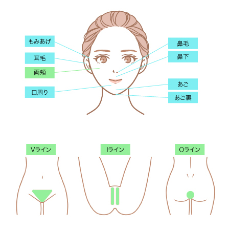 脱毛施術箇所の説明イラスト 顔、VIO